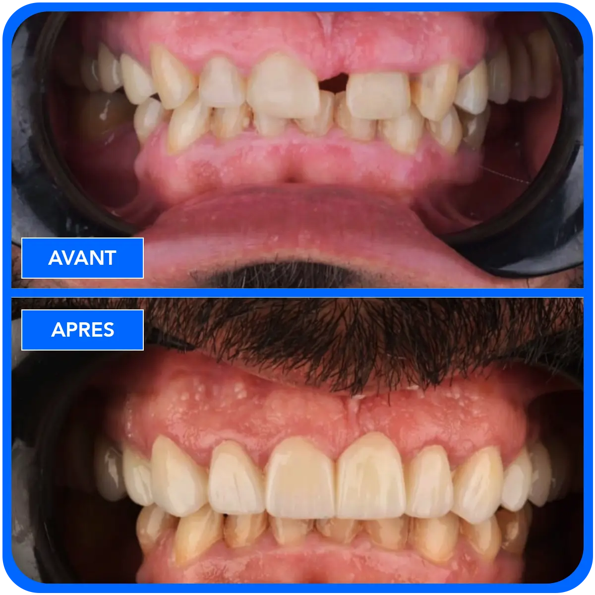 elidentclinic dentaire 1