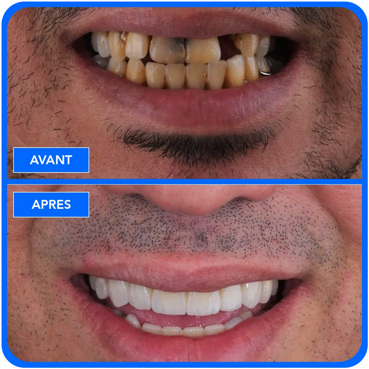 elidentclinic dentaire 10