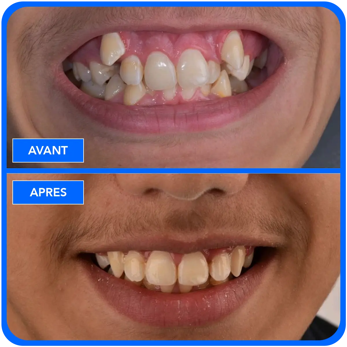 elidentclinic dentaire 11