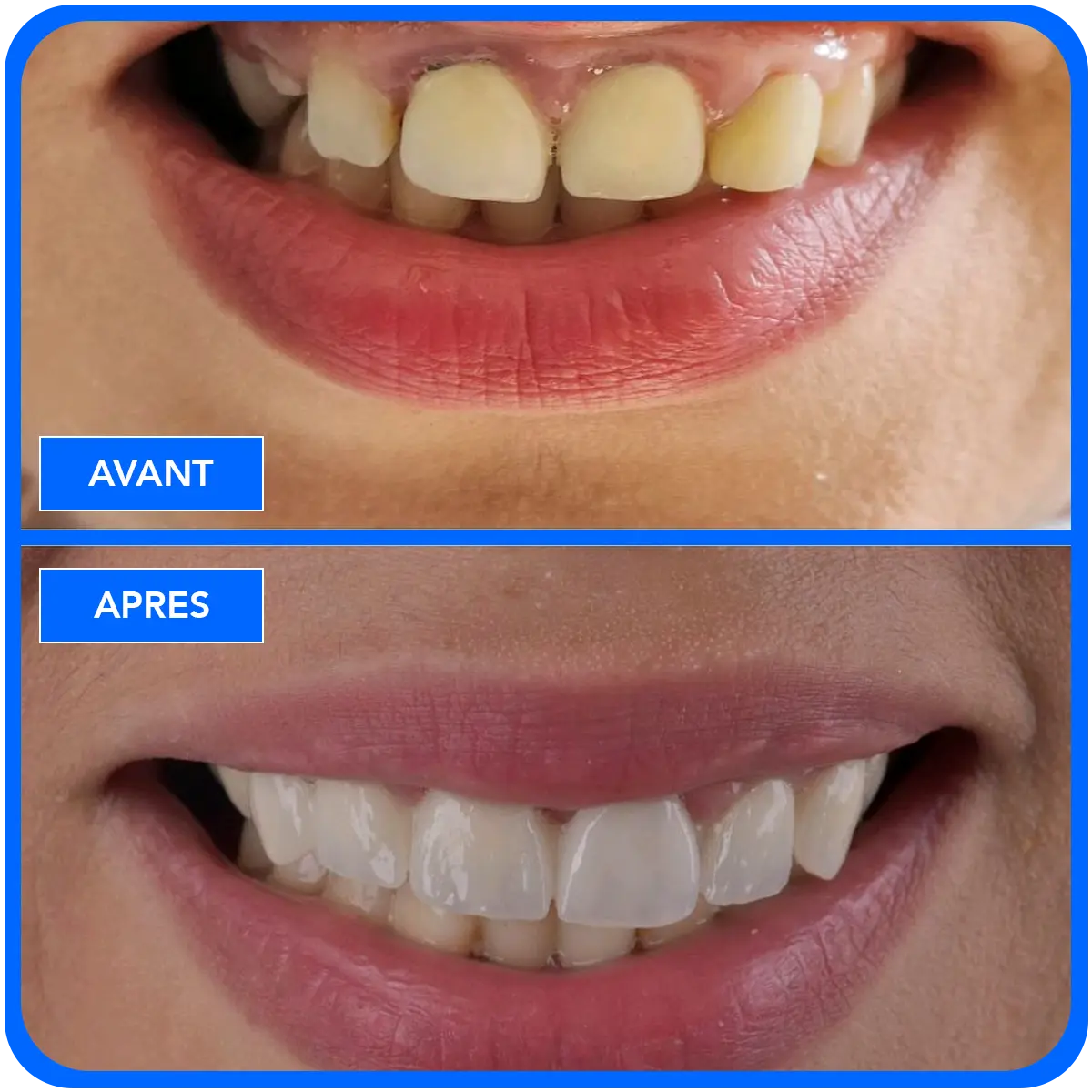 elidentclinic dentaire 12