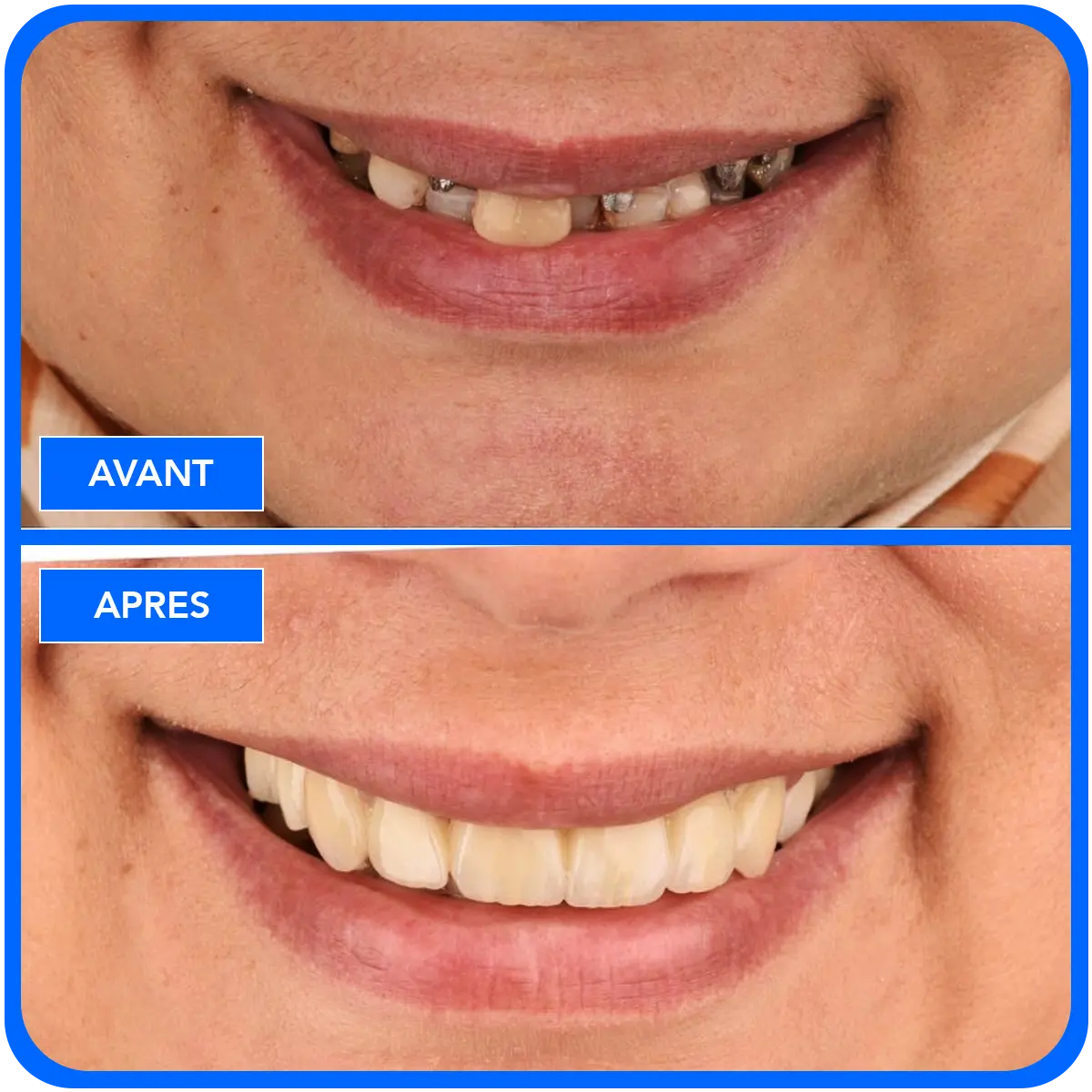 elidentclinic dentaire 13