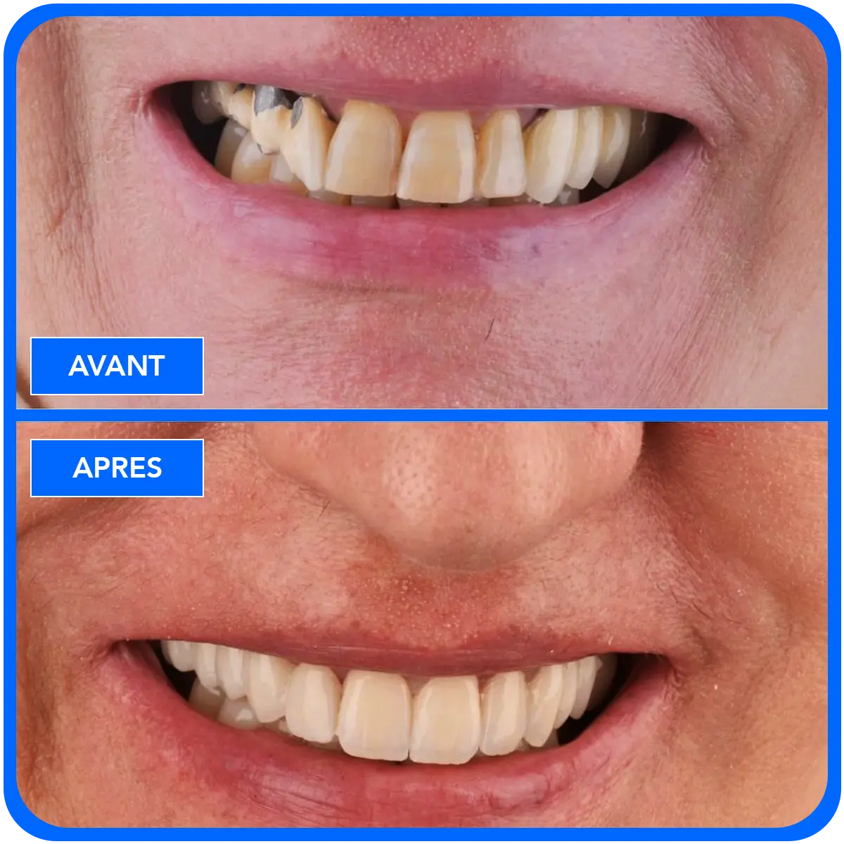 elidentclinic dentaire 14