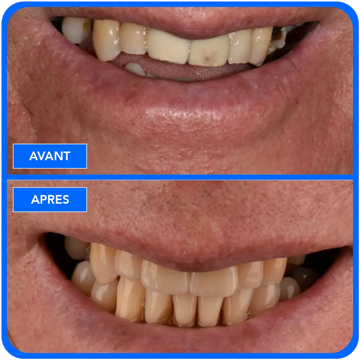 elidentclinic dentaire 15