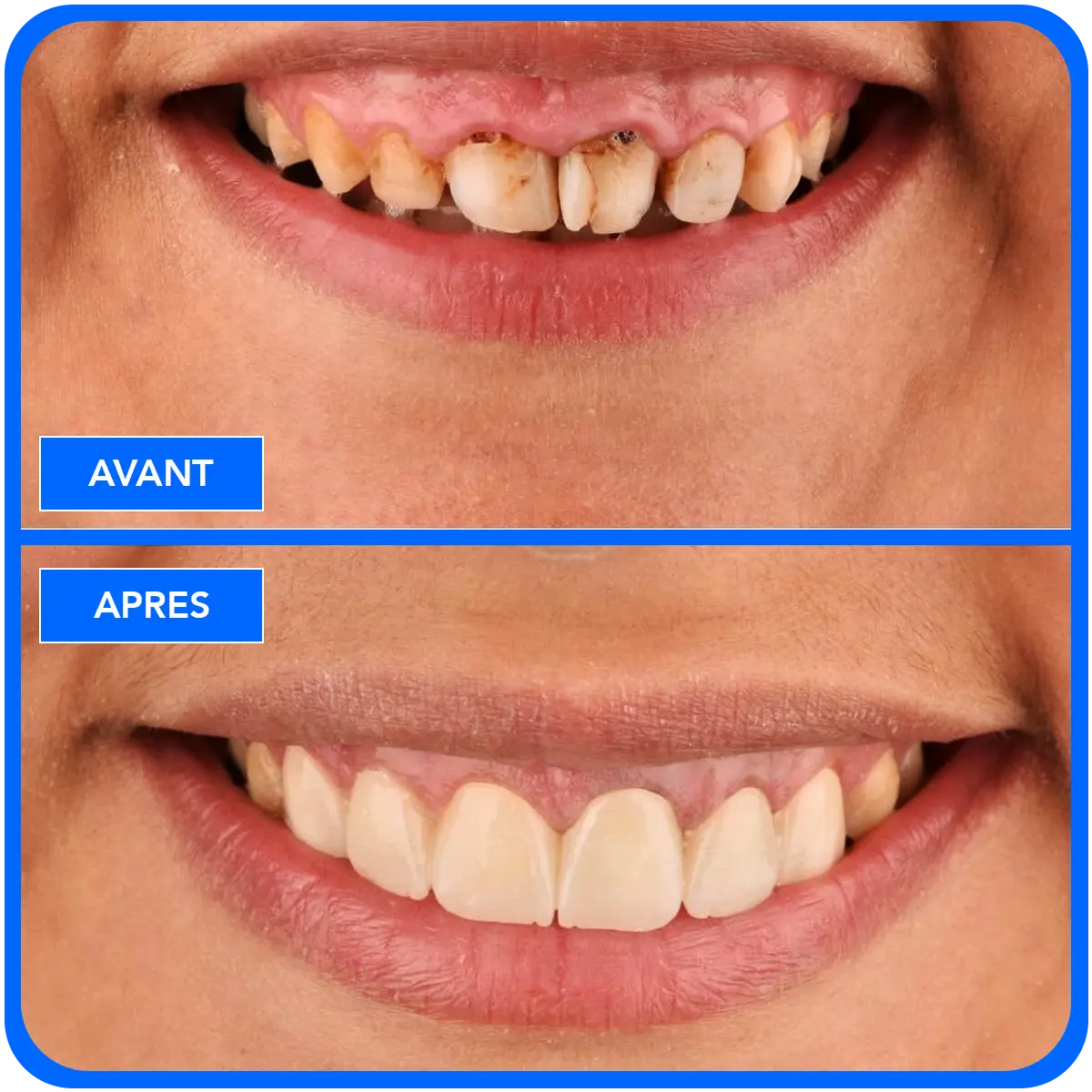 elidentclinic dentaire 16