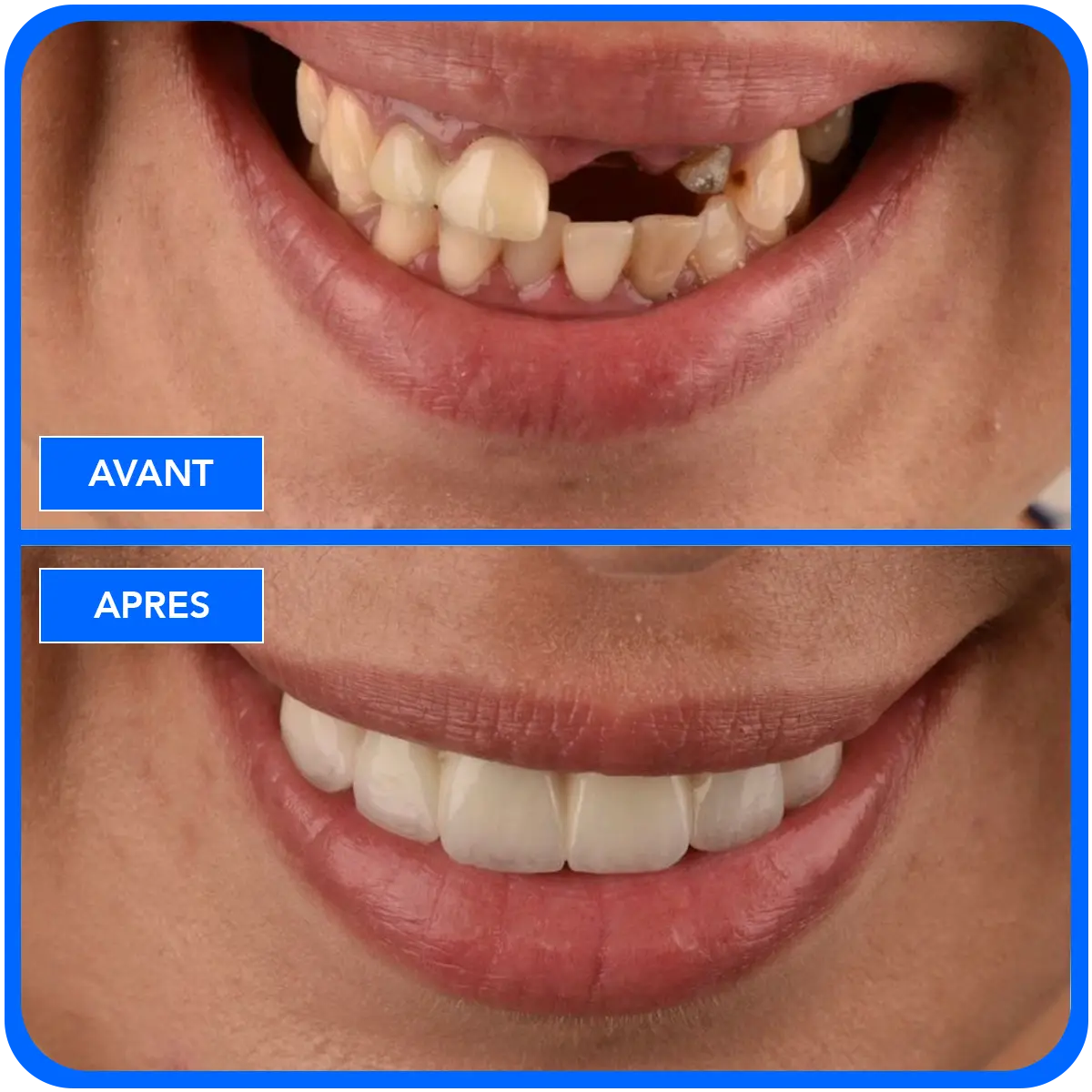 elidentclinic dentaire 17