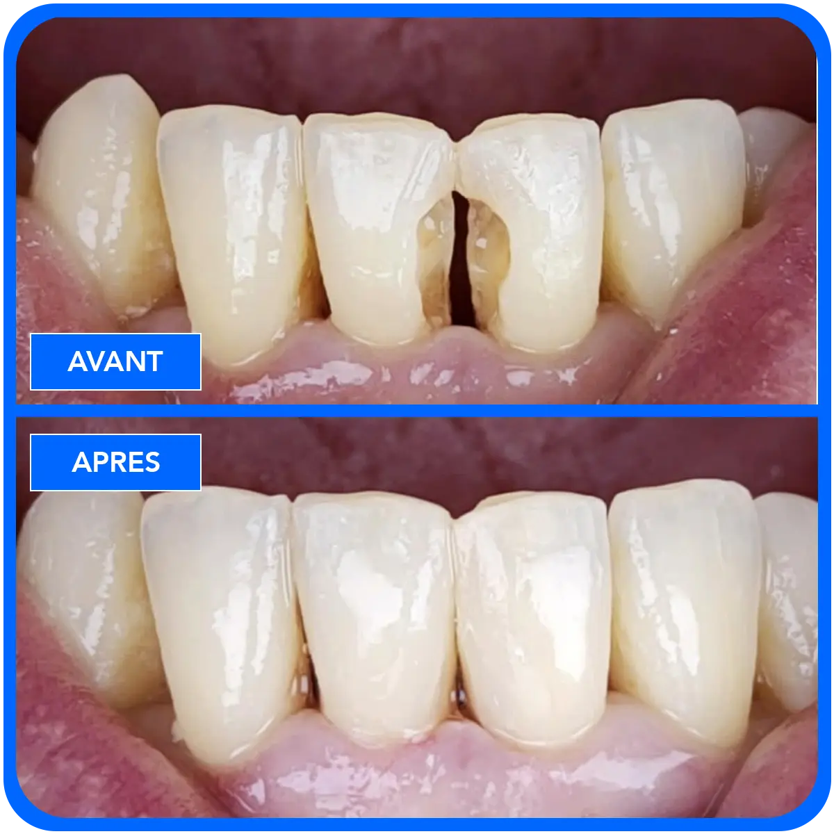 elidentclinic dentaire 18