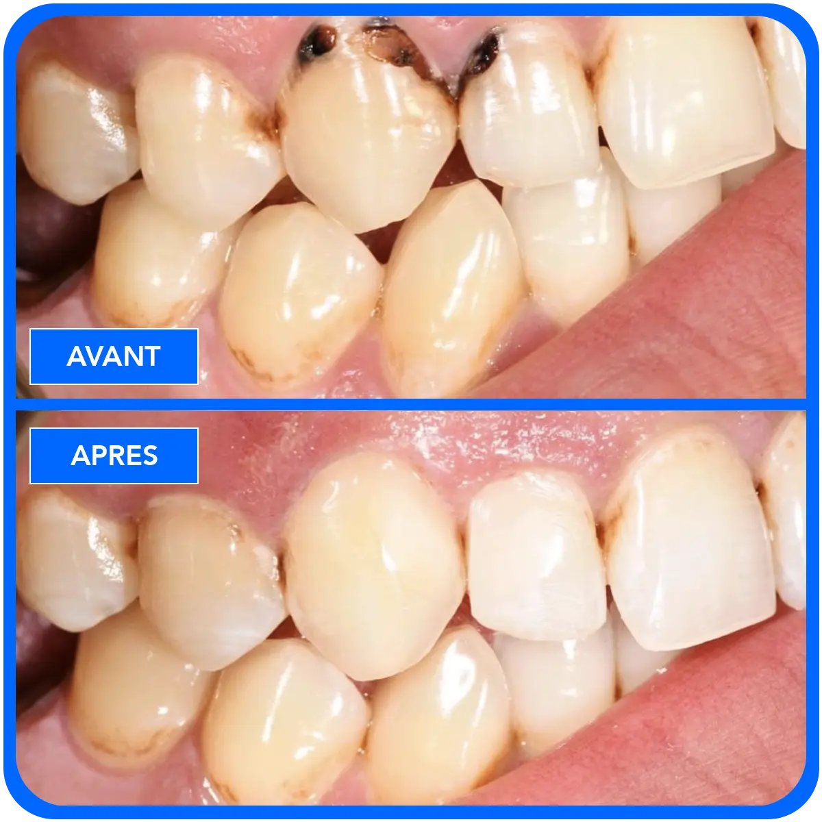 elidentclinic dentaire 20