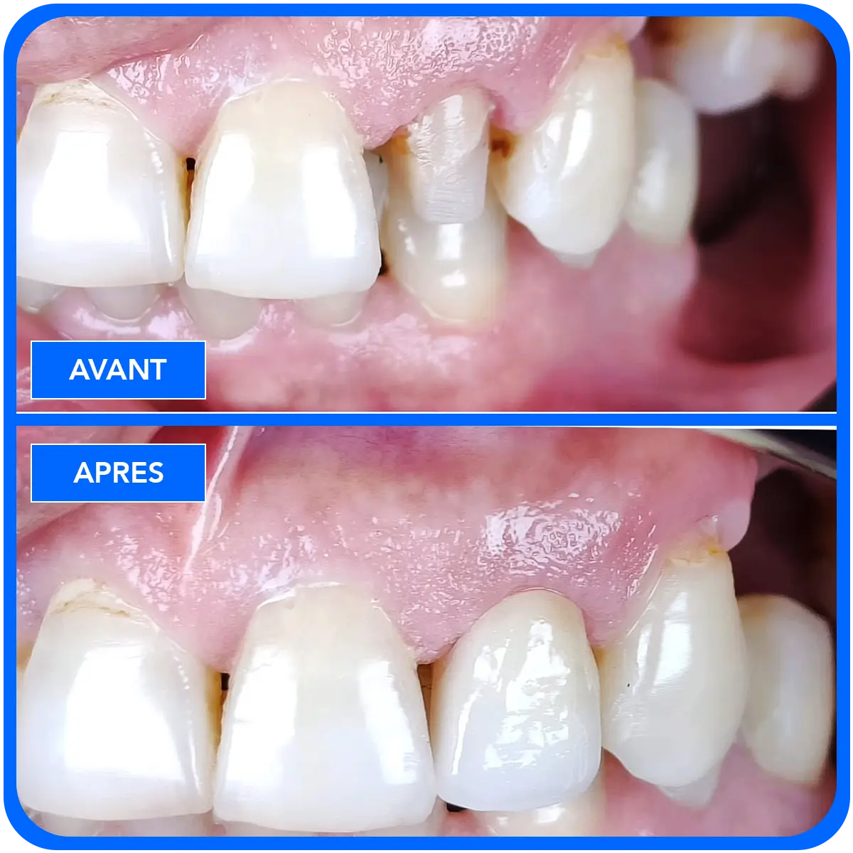 elidentclinic dentaire 3