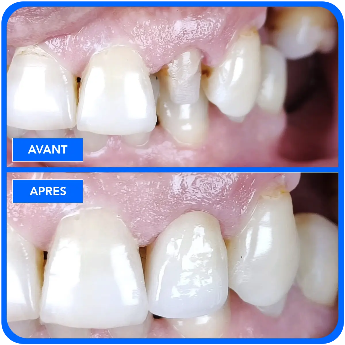 elidentclinic dentaire 4