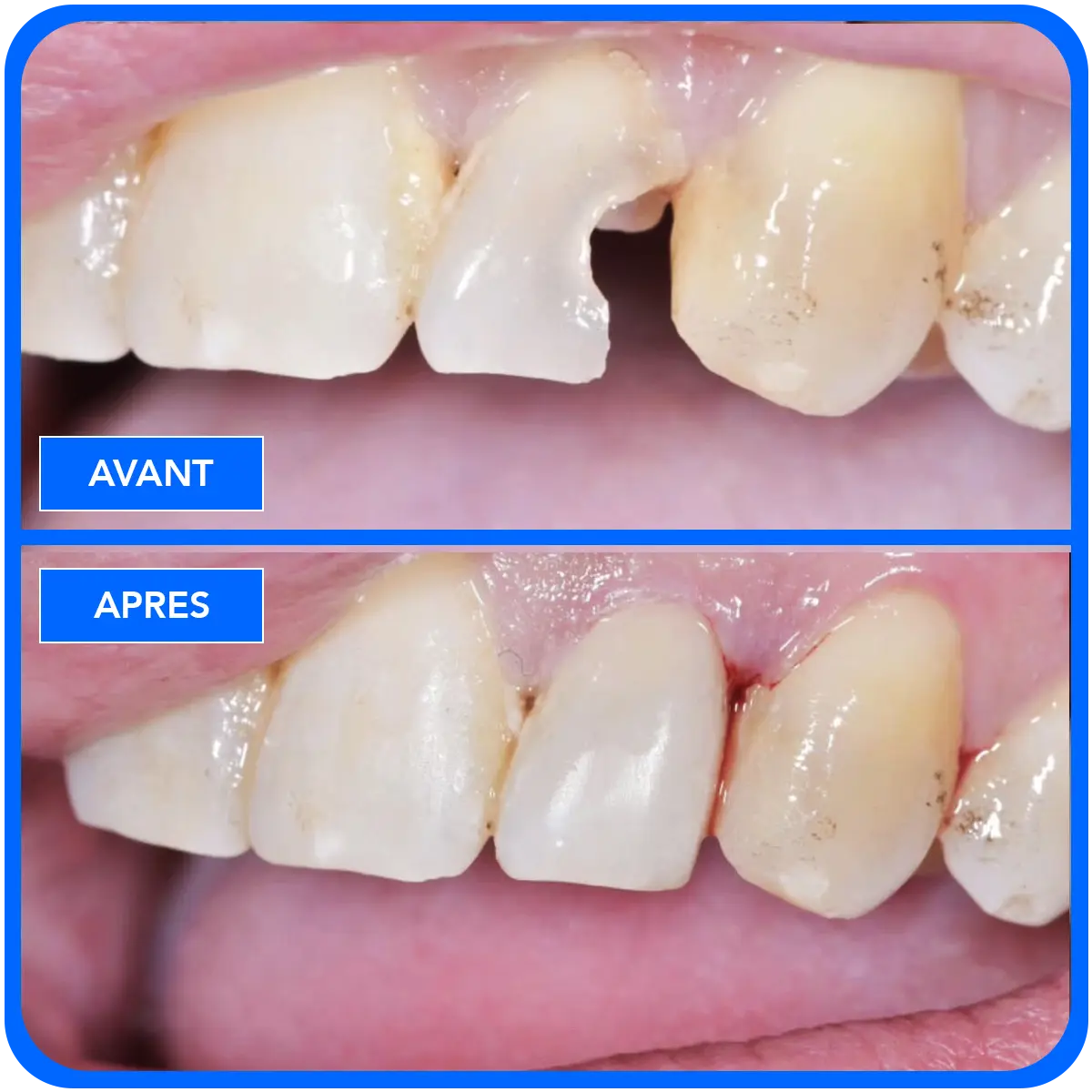 elidentclinic dentaire 5