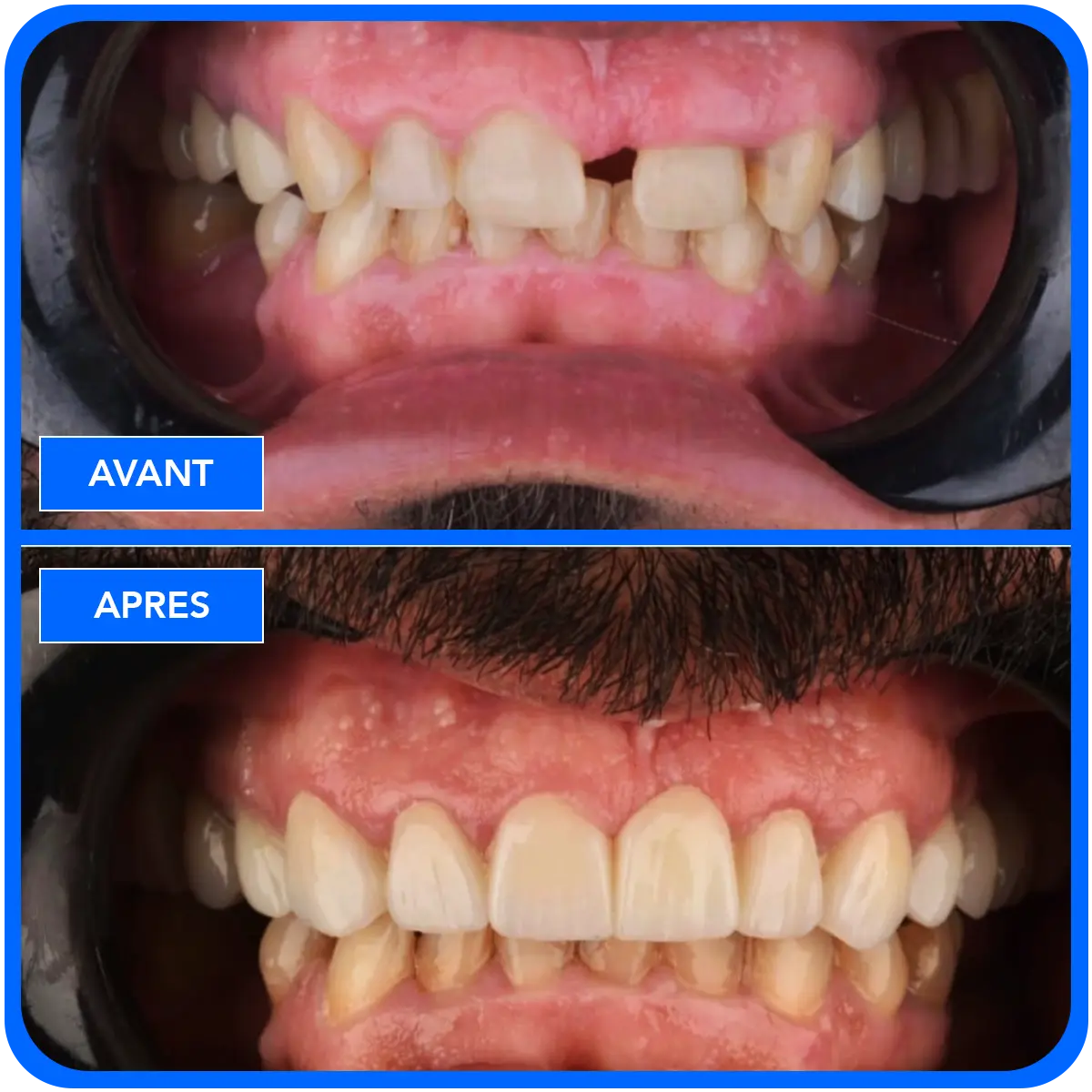 elidentclinic dentaire 8