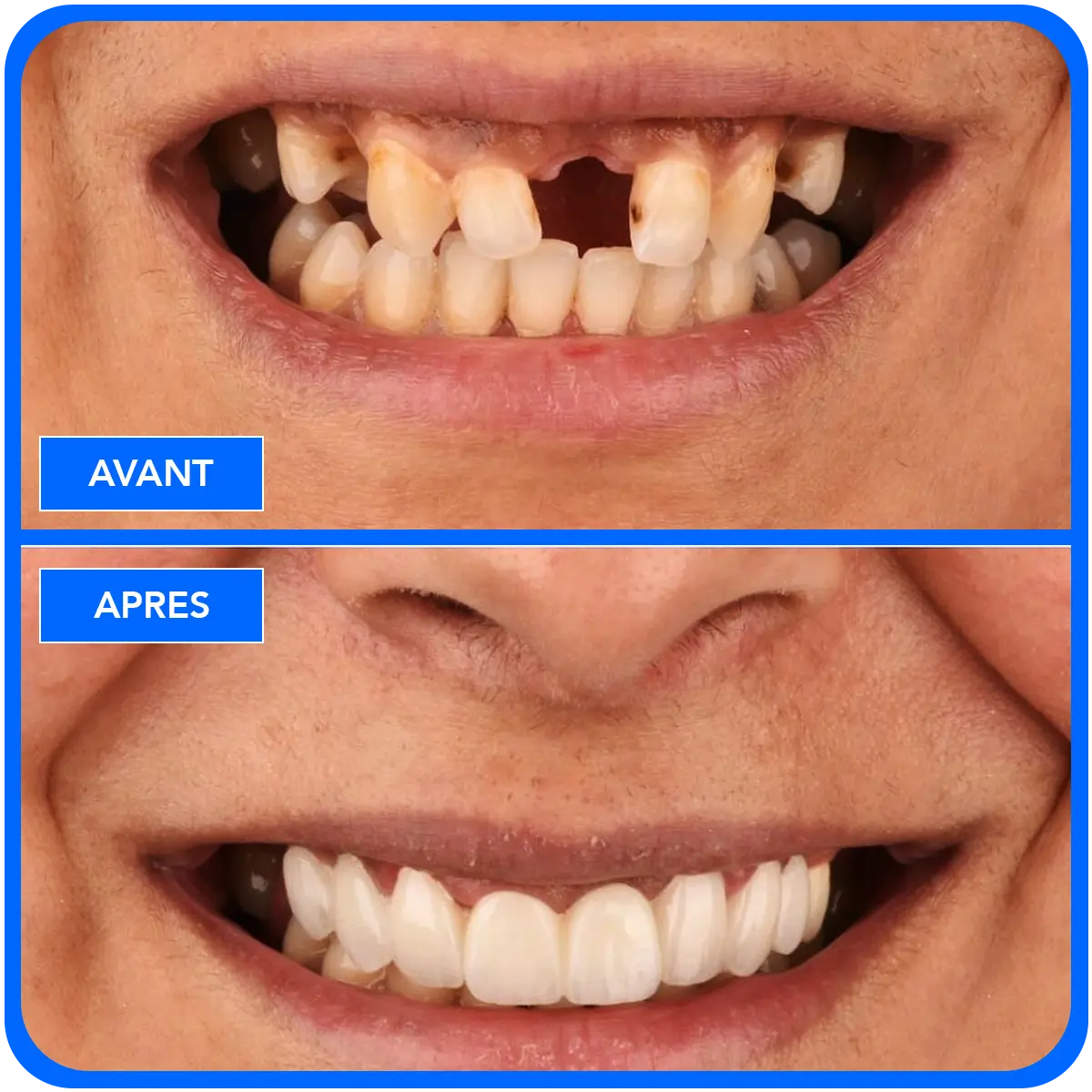 elidentclinic dentaire 9